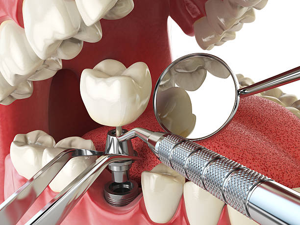 Best Urgent Dental Care for Toothache in Wichita Falls, TX